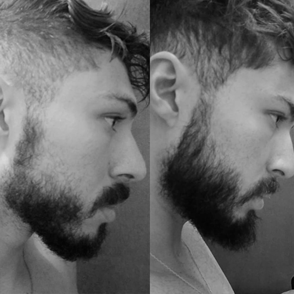 Kit Blend Original 02 Meses Barba de Respeito