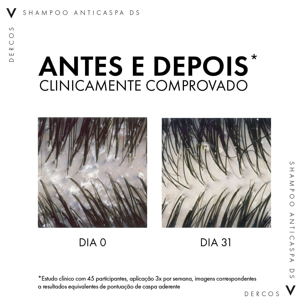 Shampoo Vichy Dercos Anticaspa Intensivo 125ml