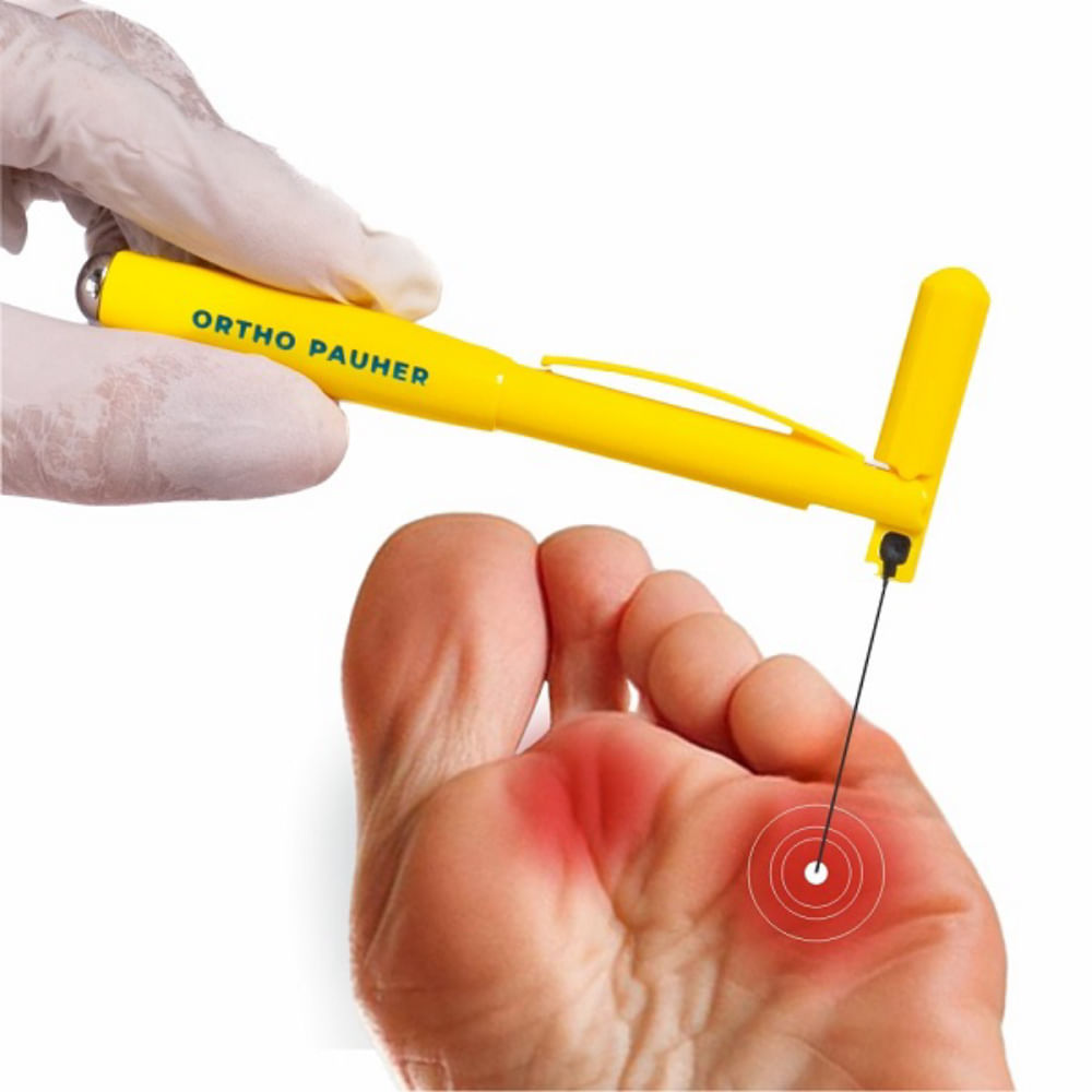 Estesiometro Monofilamento de SEMMES-WEINSTEIN ORTHO Pauher