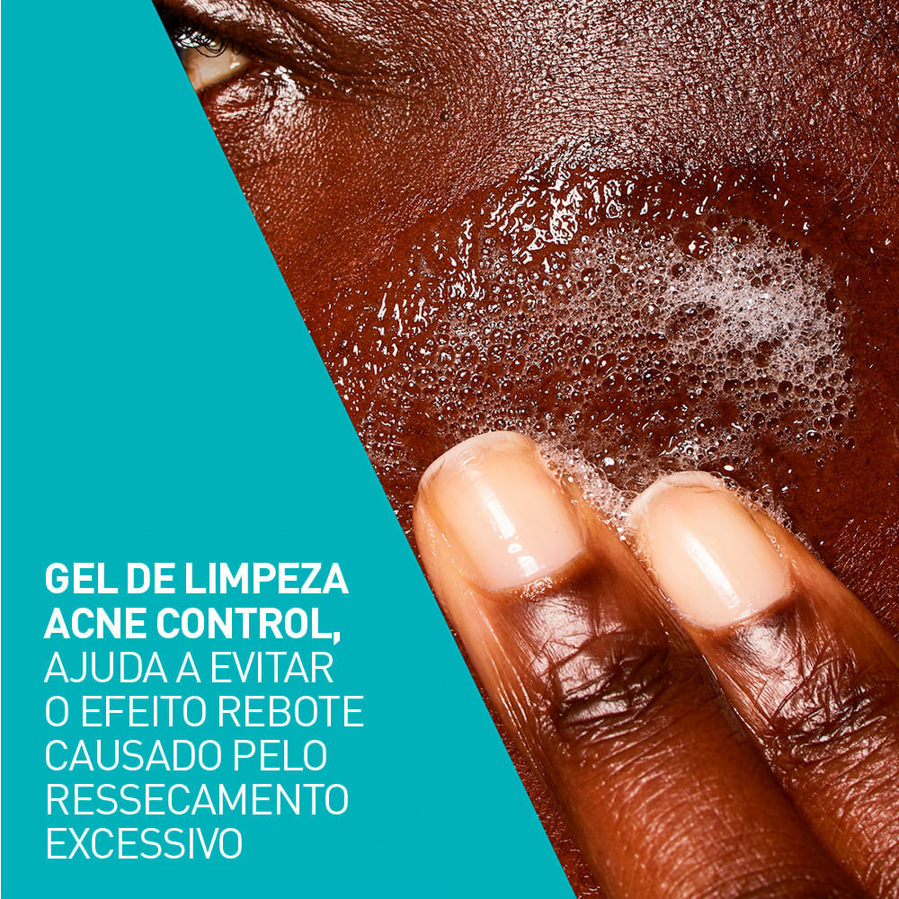 Gel Facial de Limpeza Cerave Acne Control 340g