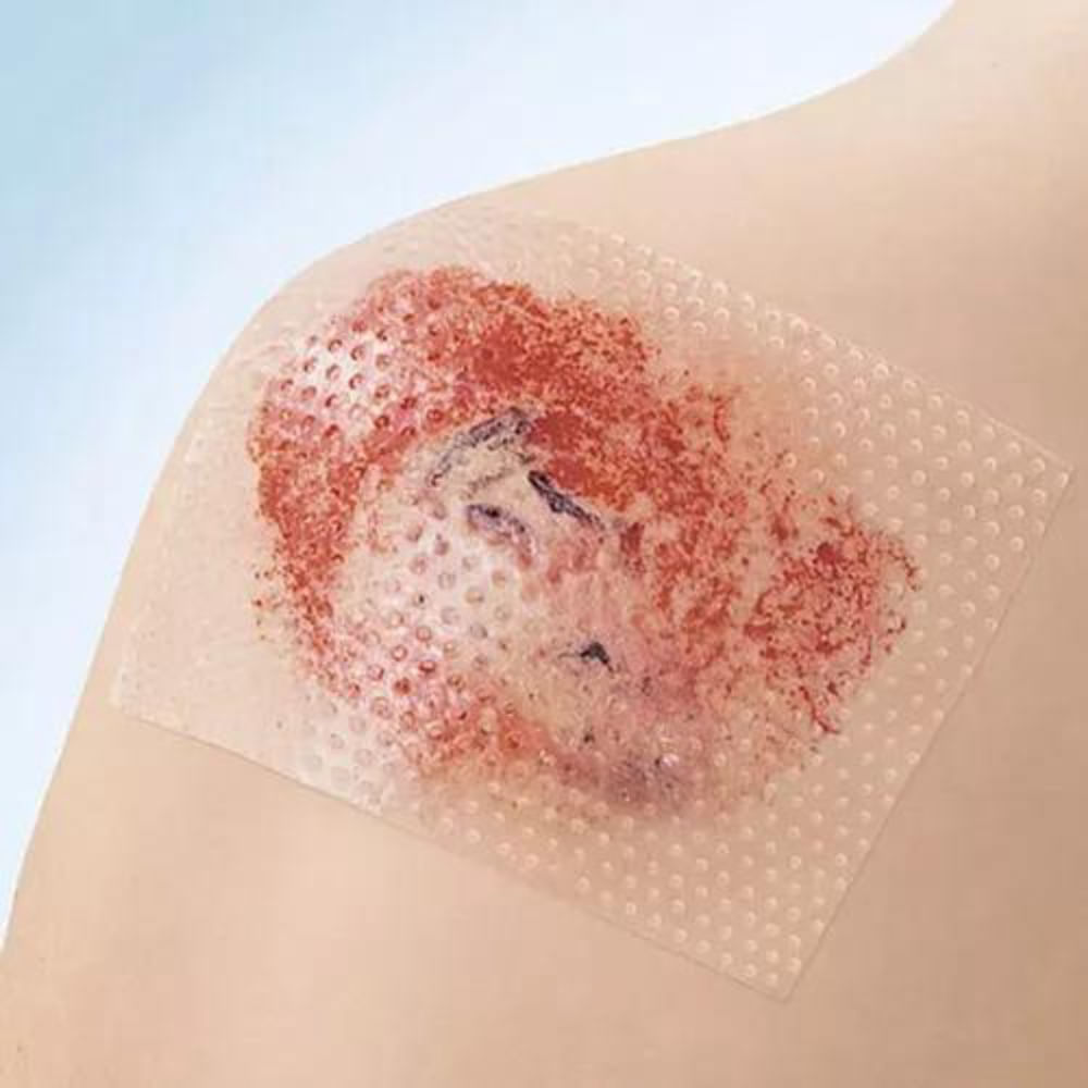 Curativo Cuticell Contact 7,5 cm x 10 cm