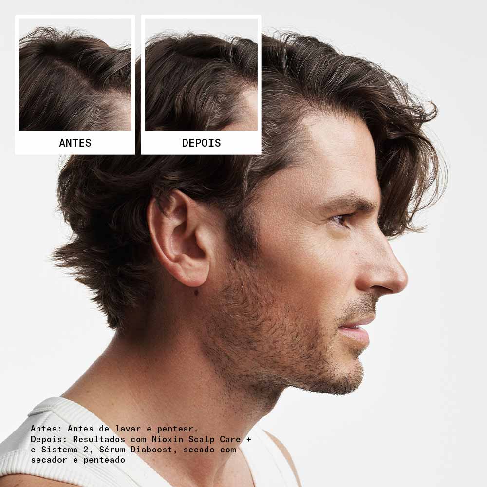 Kit Shampoo + Condicionador + Tratamento Nioxin System 2