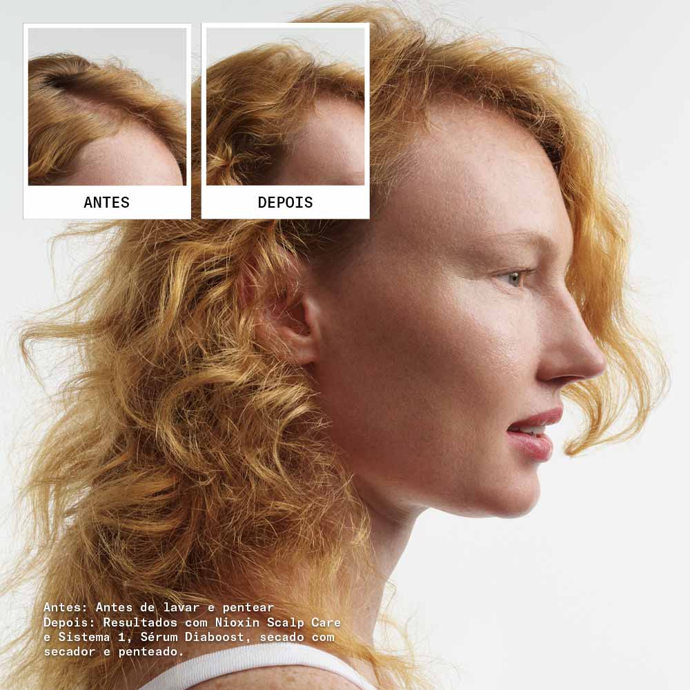 Kit Shampoo + Condicionador + Tratamento Nioxin System 1