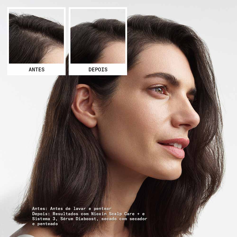 Kit Shampoo + Condicionador + Tratamento Nioxin System 3