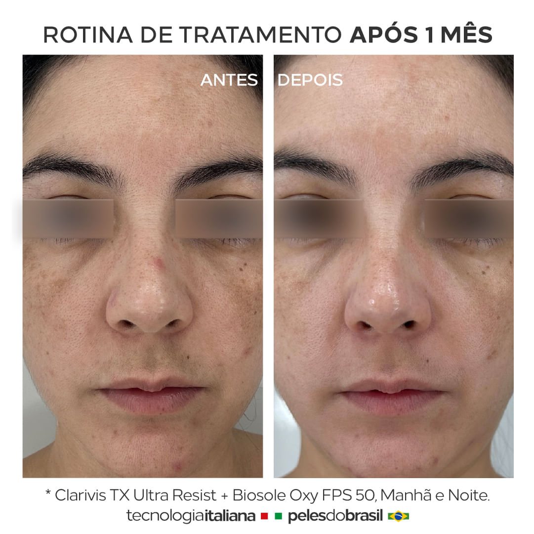 Sérum Clarivis Tx Ultra Resist Booster Clareador De Manchas E Melasma Resistente E Hormonal 30ml