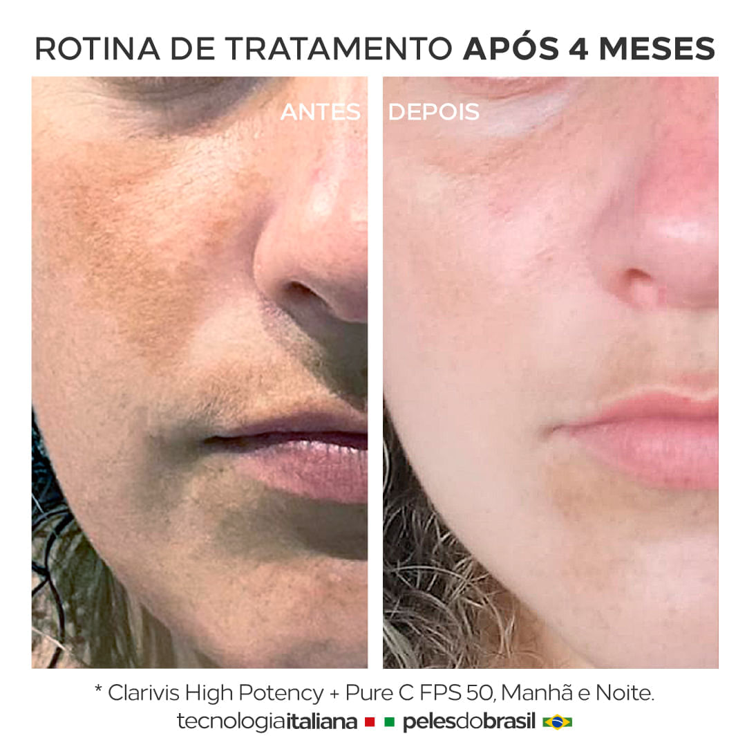 Sérum Potente Clareador de Manchas e Melasma Clarivis High Potency 30mL