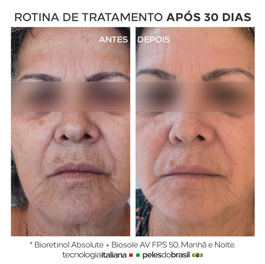 Bioretinol Absolute Sérum Retinol Biopeptides High Dose Clareia, renova e rejuvenesce mais potente que retinol puro