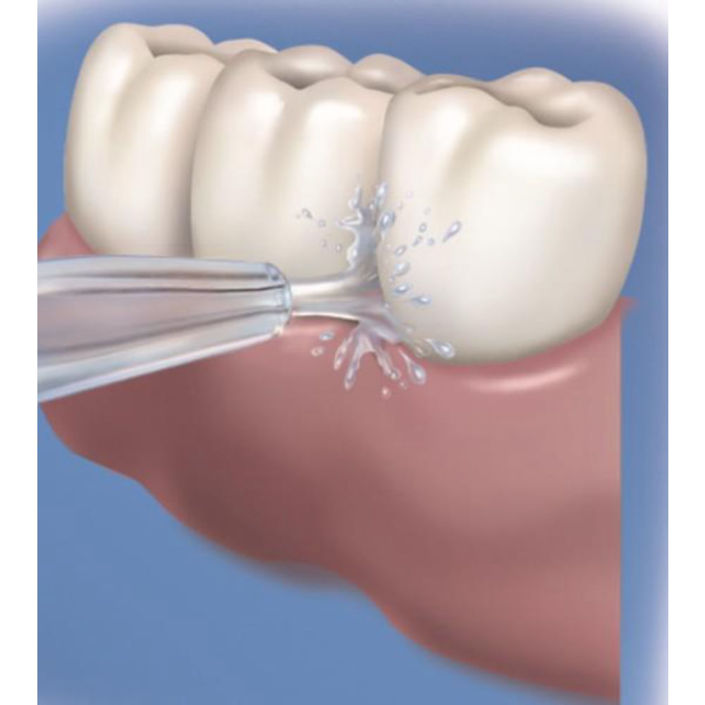 Bico Jato Clássico Waterpik 2 unidades