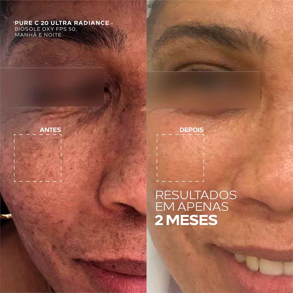 Creme Clareador Facial Pure C 20 Ultra Radiance Ada Tina 30g