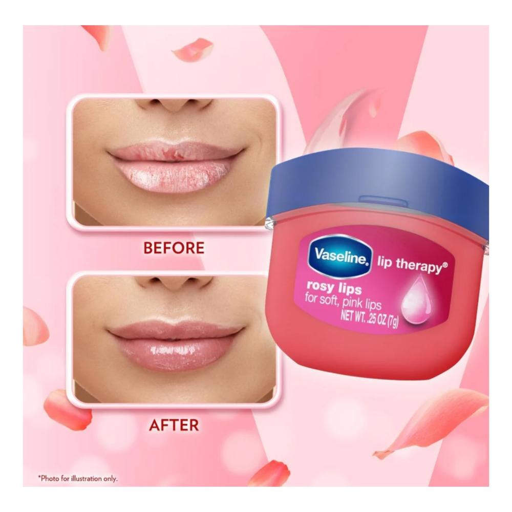 Hidratante Labial Lip Therapy Rosy Vaseline 7g 2 Unidades