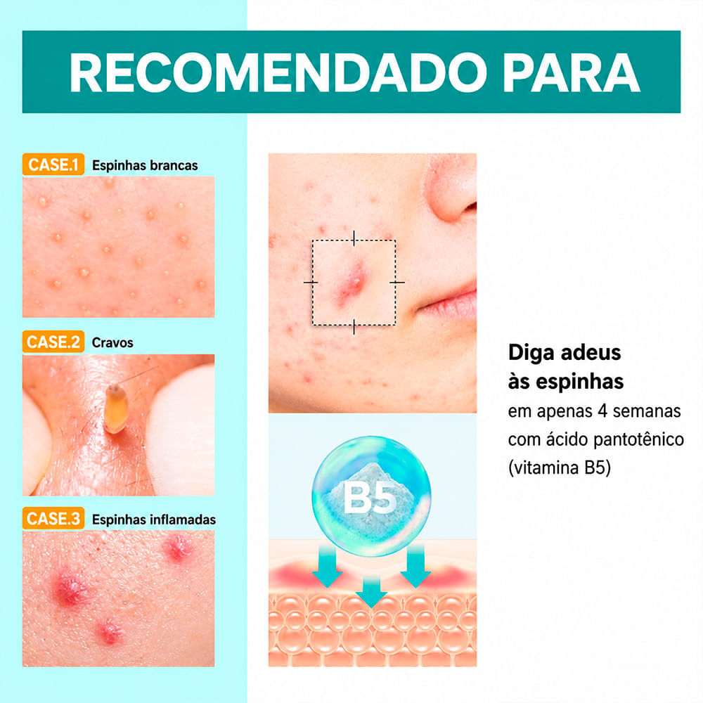 Creme Facial Calmante Numbuzin Nº 1 Pantothenic B5 Active Soothing Cream 80ml