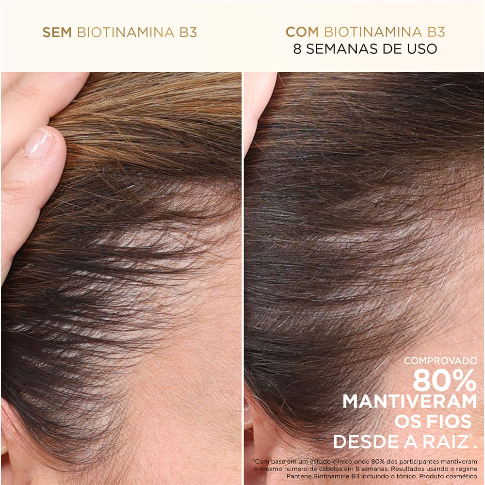 Kit Pro-V Miracles Biotinamina B3 Pantene Shampoo 510ml + Condicionador 510ml
