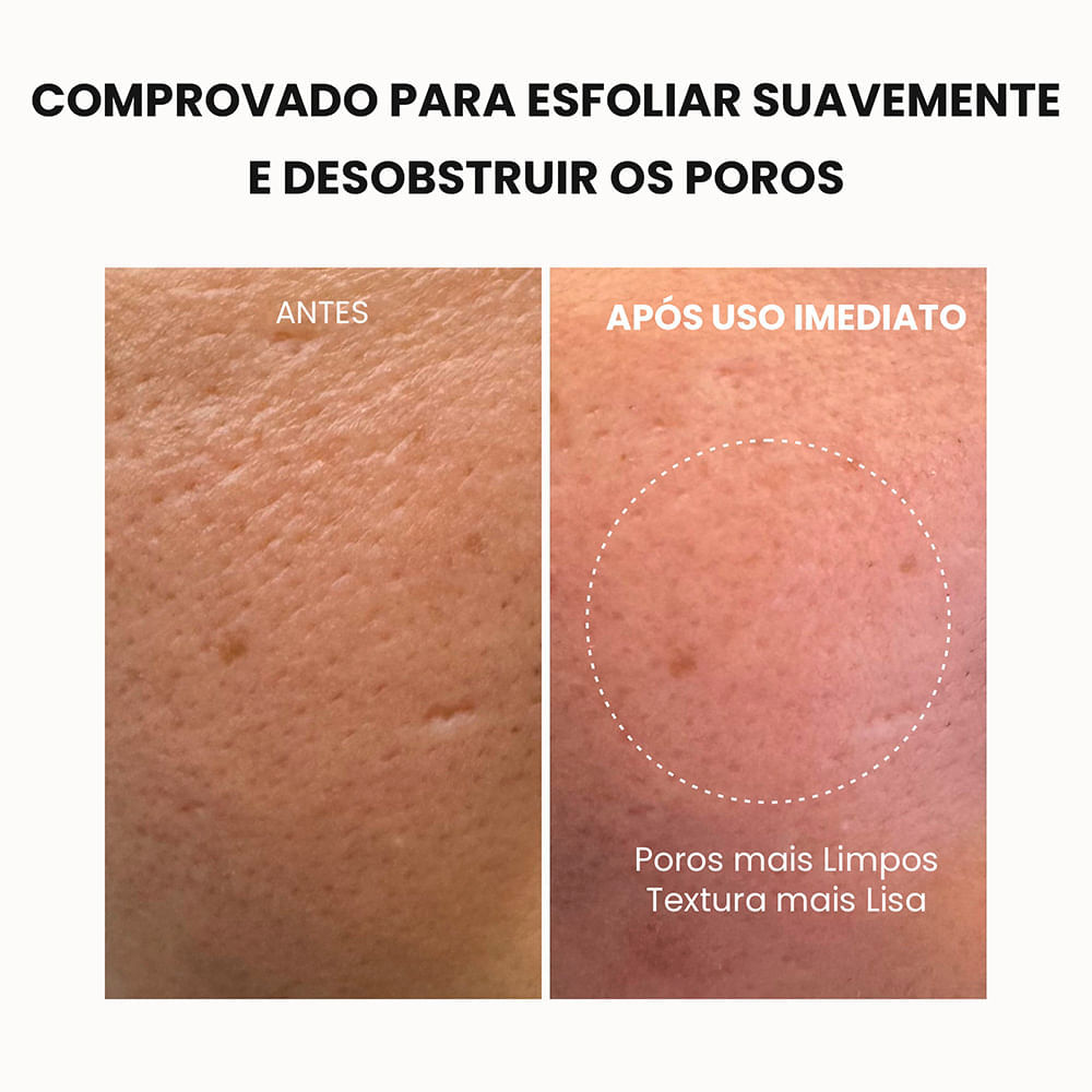 Máscara de Limpeza Facial Rice Mochi Green Arencia 120g