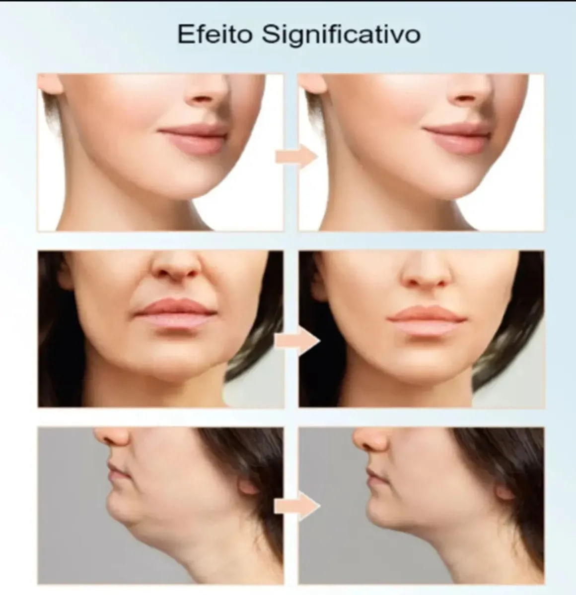 Aparelho Massagem Facial EMS V Face Anti Papada Bivolt
